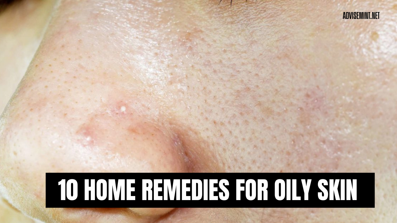 10 Home Remedies for Oily Skin
